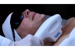Increase Practice Revenue, Achieve Better Patient Results with BBL HERO & MOXI - Video