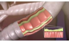 Aerobika* OPEP Device - How it Works - Trudell Medical International - Video