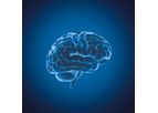 Myrian - Version XP-Brain - Head Perfusion CT