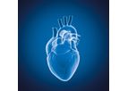 Myrian - Version XP-Vessel and XP-Cardiac - Multi-Modality Visualization of Vessel Analysis Software