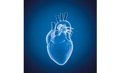 Myrian - Version XP-Vessel and XP-Cardiac - Multi-Modality Visualization of Vessel Analysis Software