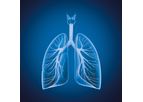Myrian - Version XP-Lung & XP-Lung Nodule - Automatic Segmentation and Analysis Tools