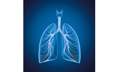 Myrian - Version XP-Lung & XP-Lung Nodule - Automatic Segmentation and Analysis Tools