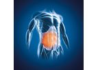 Myrian - Version XP-Abdofat - Optimize Multi-Modality Oncology Software