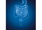 Myrian - Version XP-Colon - Optimize Multi-Modality Oncology Software