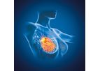 Myrian - Version XP-Breast - Mammography, Tomosynthesis, Breast MRI Or Ultrasound Examinations