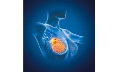 Myrian - Version XP-Breast - Mammography, Tomosynthesis, Breast MRI Or Ultrasound Examinations