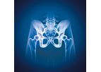 Myrian - Version XP-Female Pelvis - Mammography, Tomosynthesis, Breast MRI Or Ultrasound Examinations