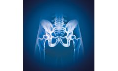 Myrian - Version XP-Female Pelvis - Mammography, Tomosynthesis, Breast MRI Or Ultrasound Examinations