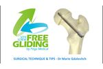 Free-Gliding SCFE Screw - Tips by Dr Marie Gdalevitch - Video