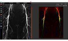 Kinepict Academy: How to generate DVA image types? - Video