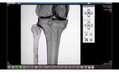 Surgeon`s Checklist TRAUMA  - Video