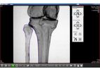 Surgeon Checklist - Version Trauma - Confirm Proper Alignment, Positioning, Accuracy of Correction