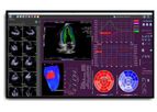Medis Suite - Ultrasound Software