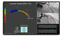 Medis - Version QFR - Quantitative Flow Ratio Software