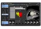 Medis Suite - Version CT - Vendor Independent Post Processing Software