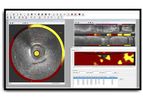 Intravascular - Vendor-Independent Post-Processing Software