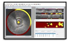 Intravascular - Vendor-Independent Post-Processing Software