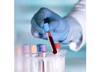 DiagnoLung - Non-Invasive Early Detection Test Cutting Edge Liquid Biopsy Technology for Lung Cancer