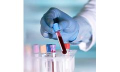DiagnoLung - Non-Invasive Early Detection Test Cutting Edge Liquid Biopsy Technology for Lung Cancer