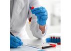 PancreaDix - Non-Invasive Signature in Blood Test Cutting Edge Liquid Biopsy Technology