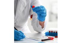 PancreaDix - Non-Invasive Signature in Blood Test Cutting Edge Liquid Biopsy Technology