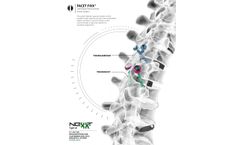 FACET FIXX - Translaminar Screw System - Brochure
