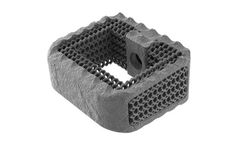 NEXXT MATRIXX - 3D Printed Porous Titanium