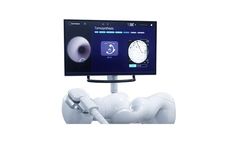 Galaxy - Model TiLT+ - Real-Time Lesion Visionary Technology
