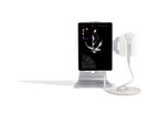 Sonoscanner - Model U-Lite - Ultra-Portable Ultrasound