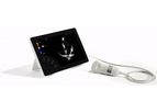 Sonoscanner - Model T-Lite - Ultraportable Ultrasound Scanner