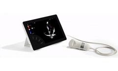 Sonoscanner - Model T-Lite - Ultraportable Ultrasound Scanner