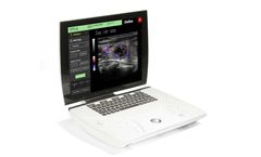 Sonoscanner - Model Ondina - Hybrid Portable Ultrasound Scanner