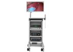 DeepEye - Model EVS100 - 2D Video Endoscopy System