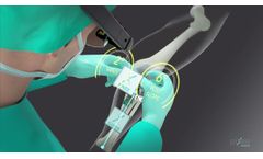 Pixee - Model Knee+ - Augmented Reality Navigation Device for Total Knee Arthroplasty