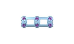 Defender - Anterior Cervical Plate