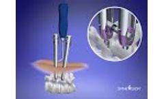 Lumis - Product Presentation - Video