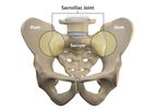 Alevio - Sacroiliac Joint
