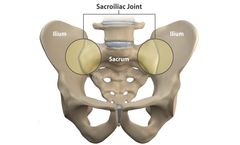 Alevio - Sacroiliac Joint