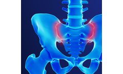 Alevio - Model SI - Diagnosing Sacroiliac Joint Pain