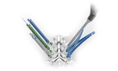 Atlas - Model Apelo MIS - Pedicle Screw System