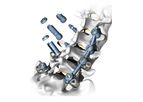 Atlas - Model Apelo - Pedicle Screw System