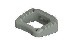 Alta - Cervical Cage
