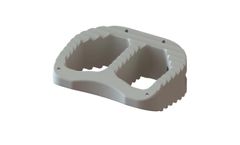 Keystone - Model ALIF - Anterior Lumbar Interbody Fusion Device