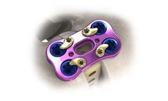AccuFit - Lateral Plate System