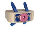 Vault - Model ALIF - Midline Screw System