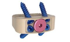 Vault - Model ALIF - Midline Screw System