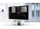 Caas - Version vFFR - Workstation Software for Novel Angio-Based Functional Lesion Assessment