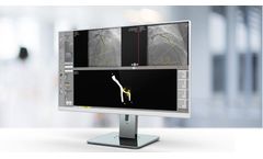 Caas - Version QCA - Quantitative Coronary Analysis Workstation Software
