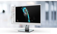 Caas - Version MR 4D - Complete Flow Assessment Software